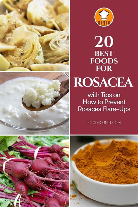 what foods help with rosacea